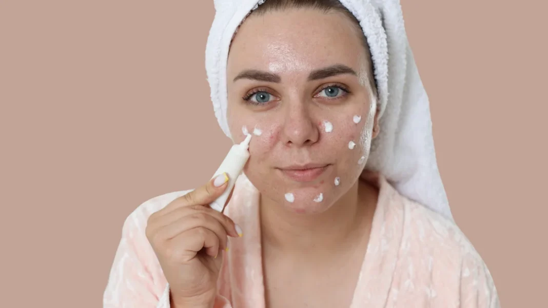 Acne & Pimple Treatment for Pakistani Girls – Simple Routine